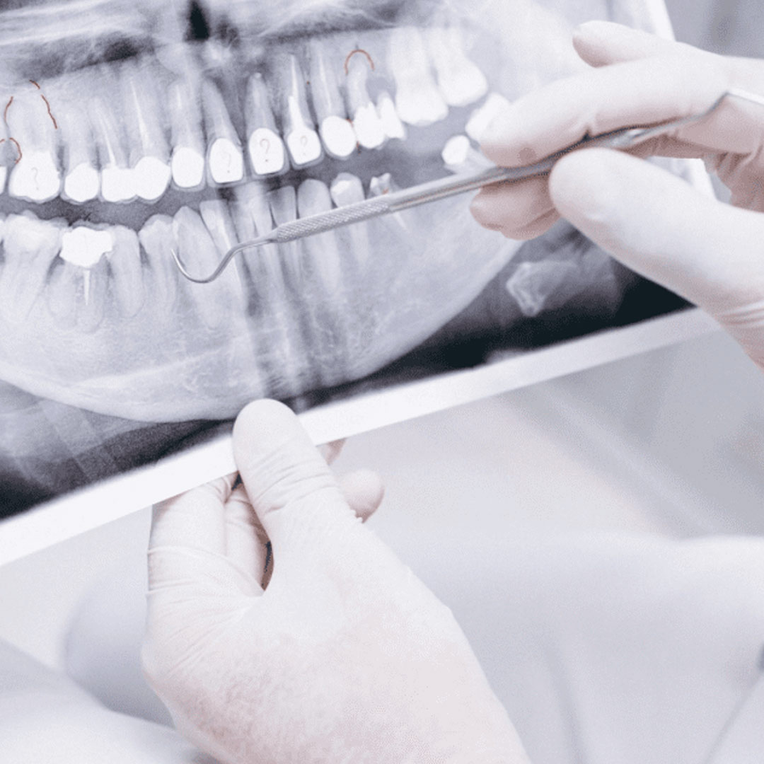 Dental Radiology available in online  pharmacy qatar, doha 
